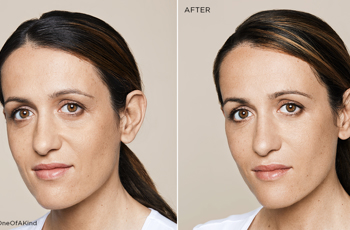 Facebook Before And After 1