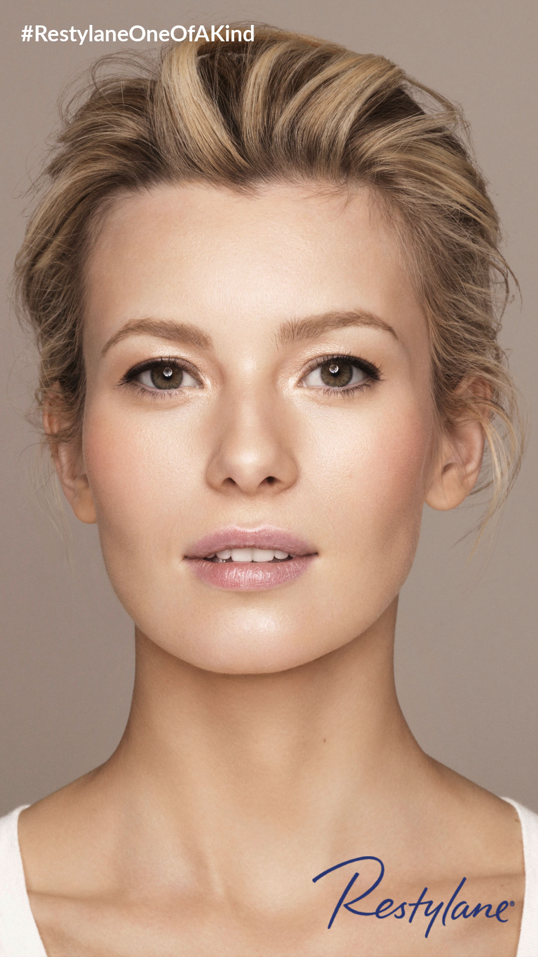 Restylane Alex1 Facebook Insta Story 1080 X 1920