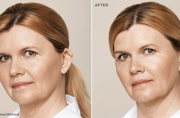 Facebook Before And After 4